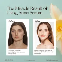Beauty and Personal Care Serum Before After Result Instagram Post