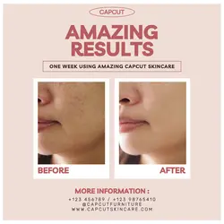 Beauty Personal Care Effect Display Before After