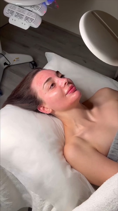 Facial