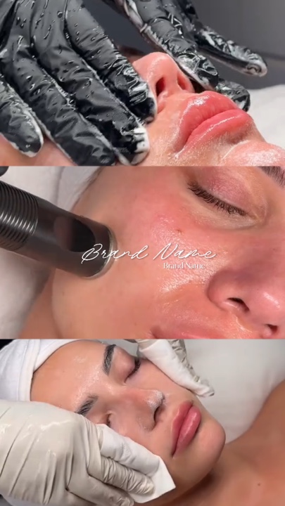 Facial