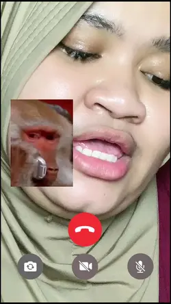 Video Call