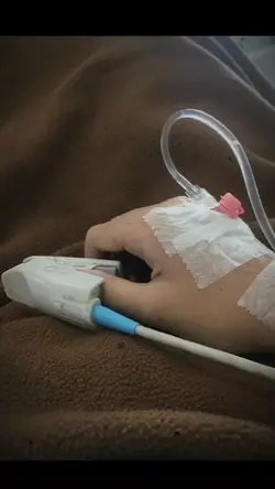 trauma