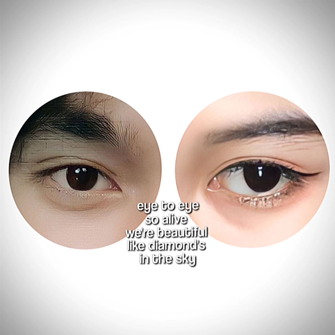 Trend Auge in Auge