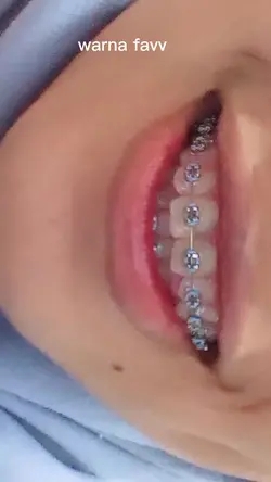 behel