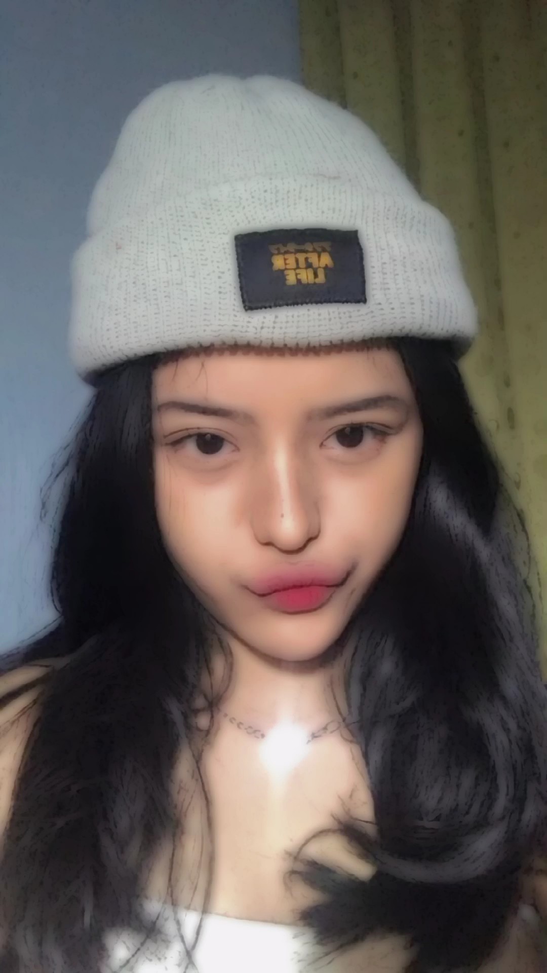 Filtro estetik