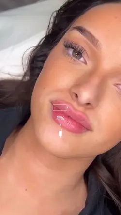 Microneedling aesthe