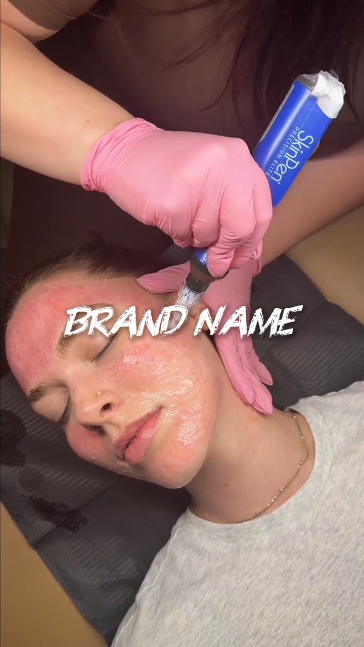 Micro needling