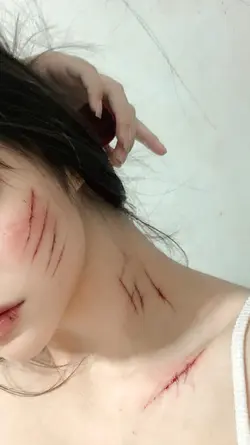 AI WOUNDS