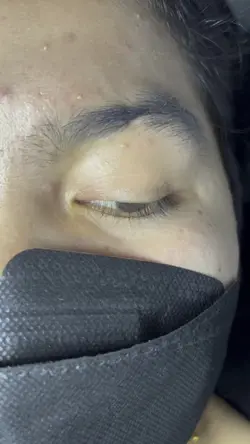 Eyelash