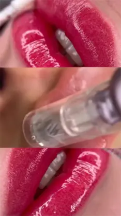 Hydragloss  