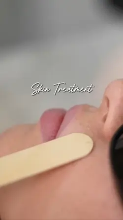 Skin Treatment 