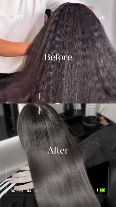 Antes Depois