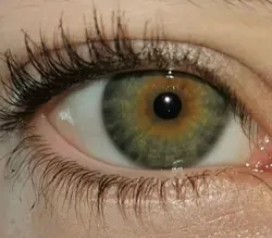 eye filter