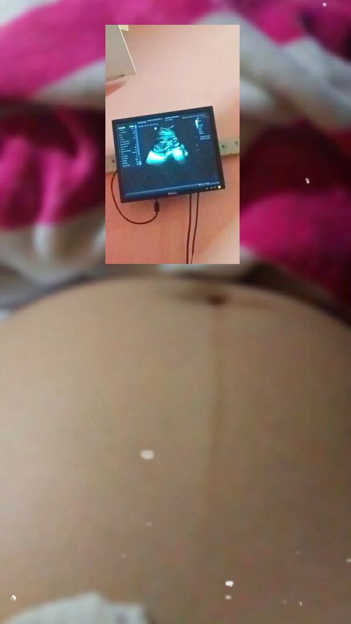 Pregnancy