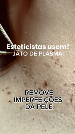 JATO DE PLASMA