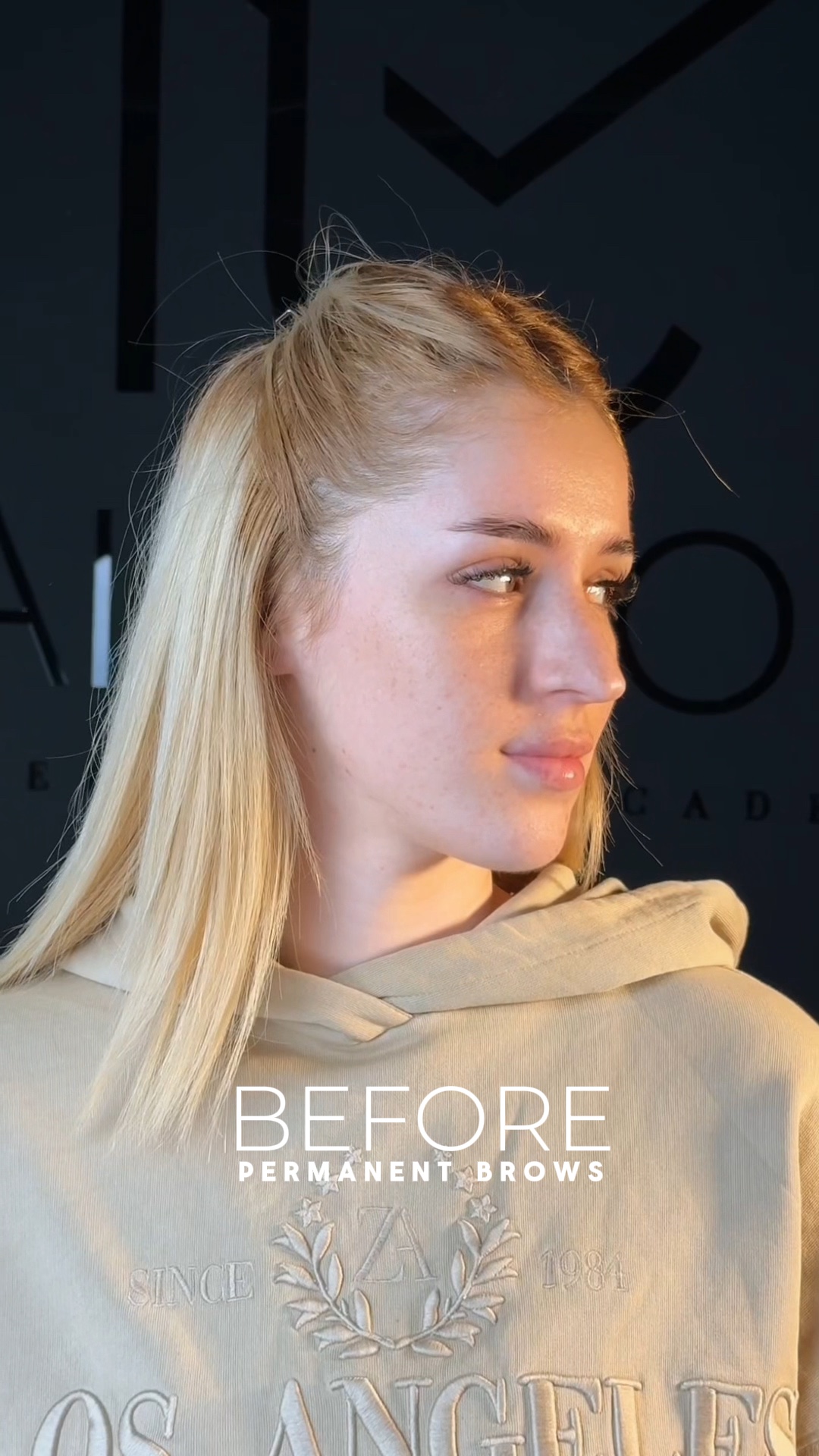 Before After