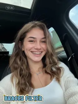 Braces filter