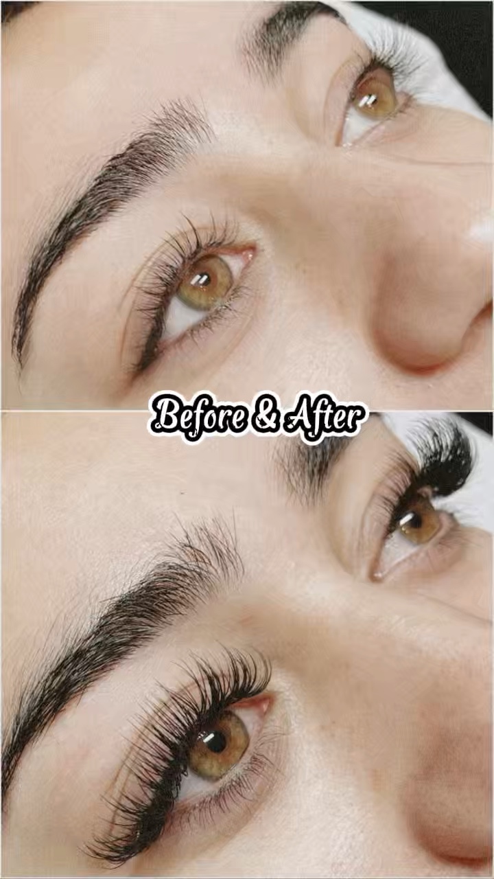 Ojo antes y después