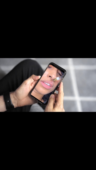 Relleno de labios
