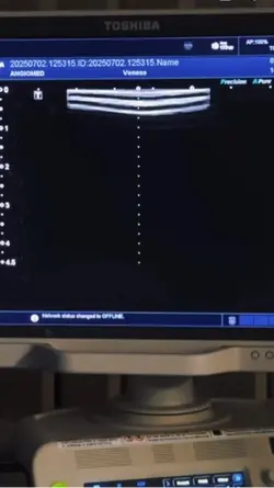 Procedimentos varize