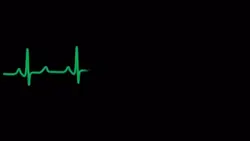 heartbeat flatline