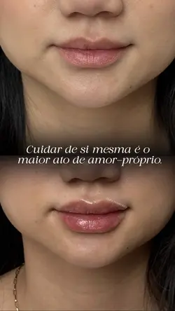 Antes e Depois