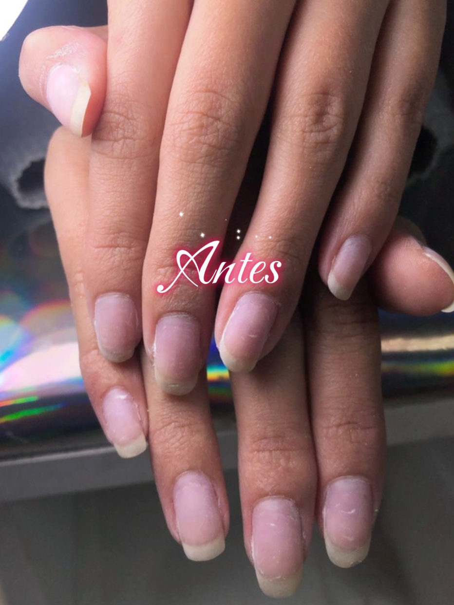 antes y después uñas