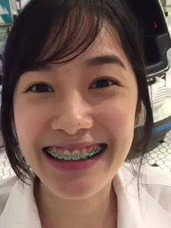 ฟันเหล็กเด็กแนว