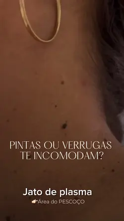Jato de Plasma