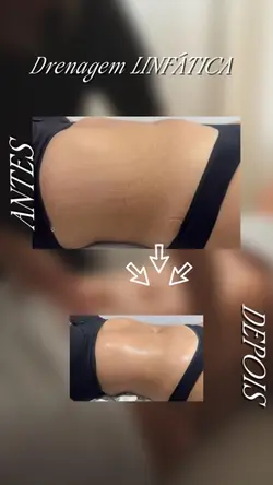 Antes e depois corpo
