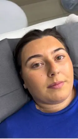 Lash lift