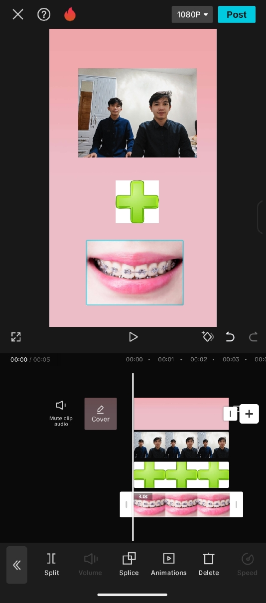 photo w/ brace