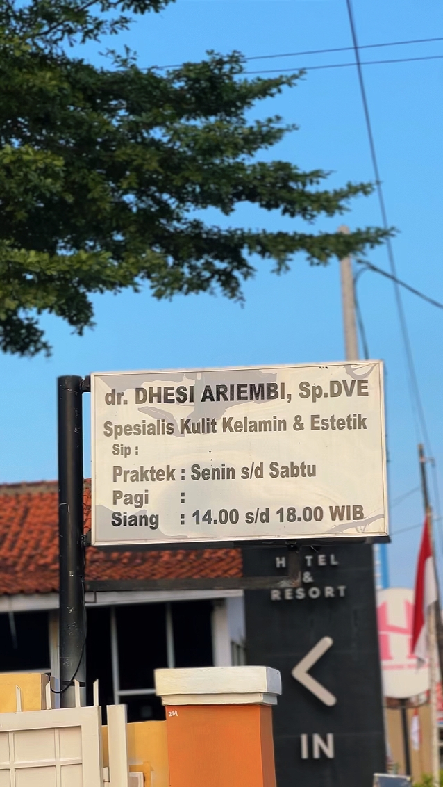 ÖPÜCÜK YABANCILAR