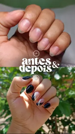 Antes e depois 