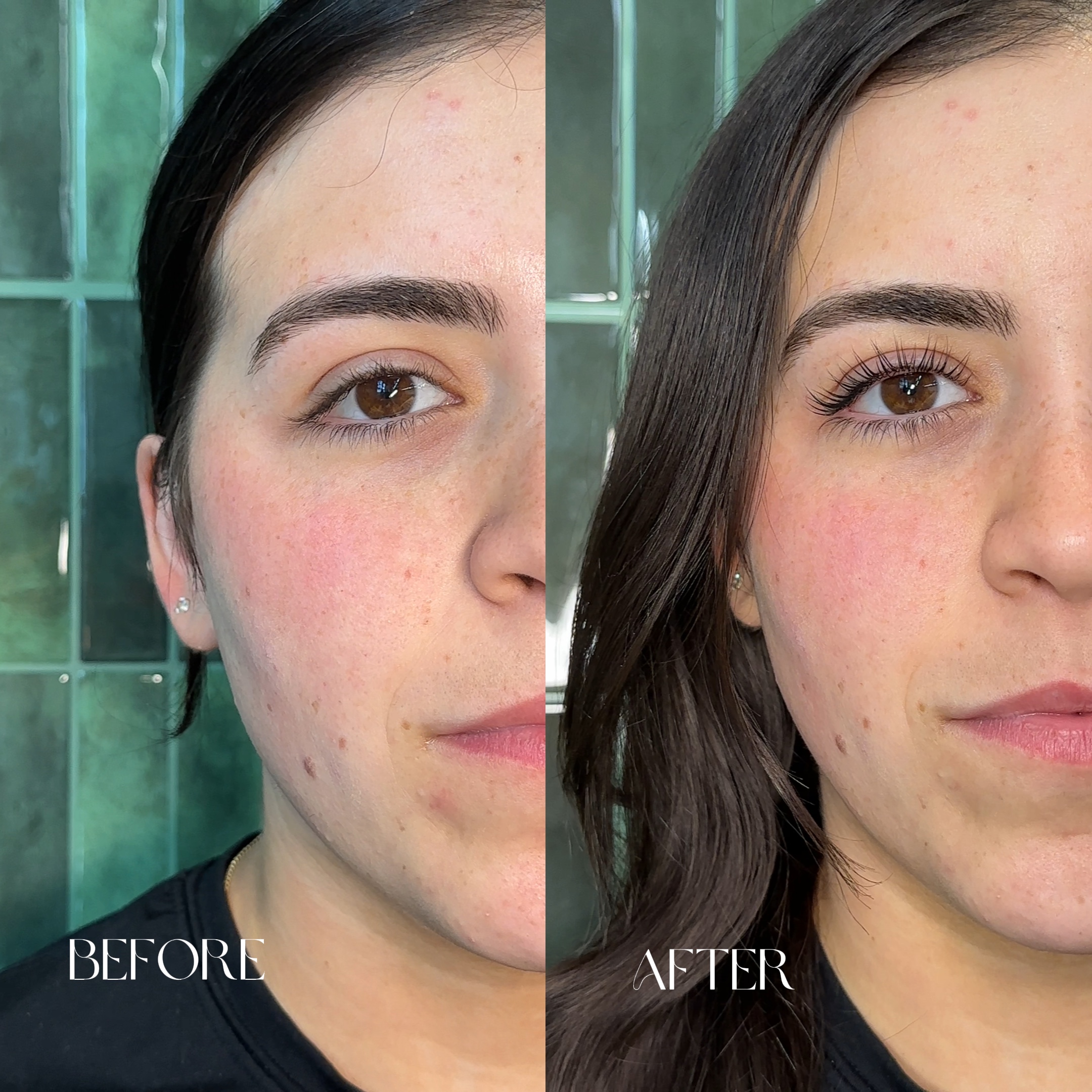 Antes e depois
