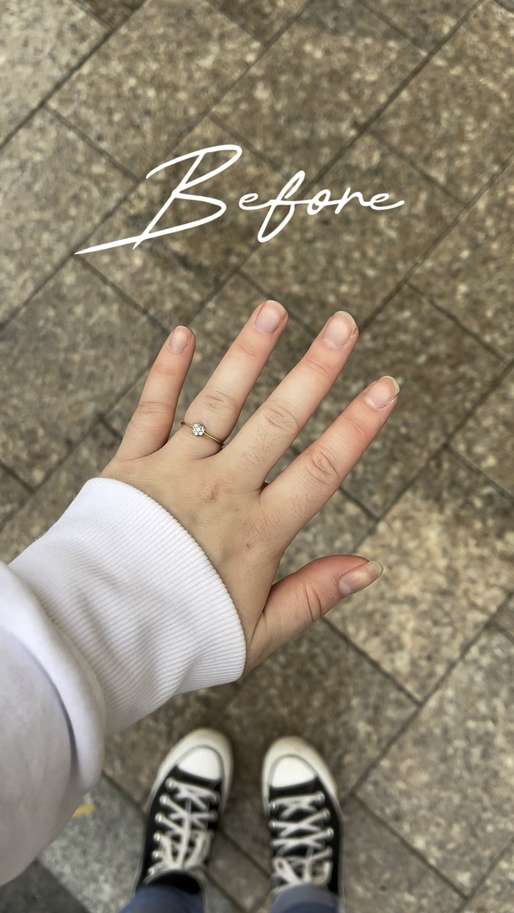 TRANSIÇÃO DE UNHAS 
