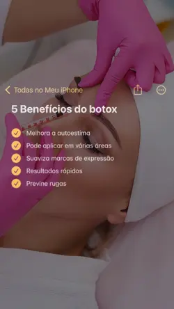 Benefícios do botox 