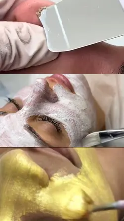 Estética facial 