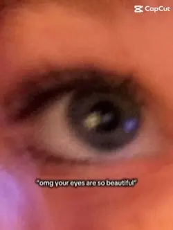 Eyes